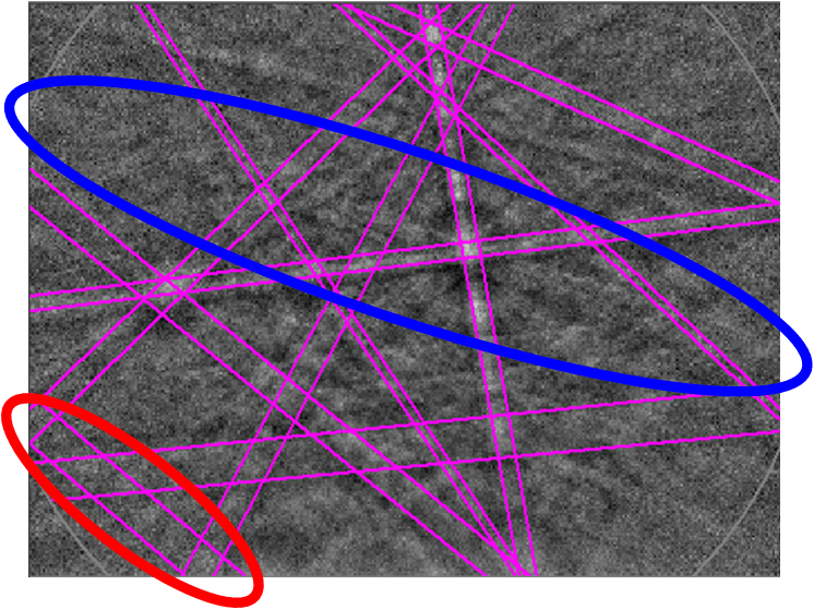 EBSD pattern showing the detected bands using a standard band detection approach