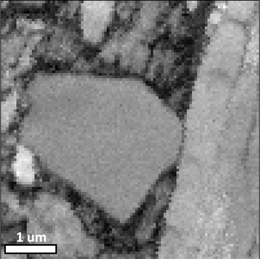 EBSD pattern quality map of martensitic steel collected at 20 kV accelerating voltage