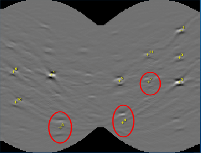 Hough transform image from the optimised band detection of an Al TKD pattern