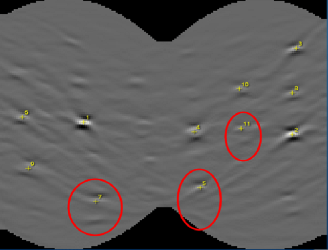 Hough transform image from the standard band detection of an Al TKD pattern